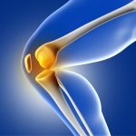 Χονδροπάθεια γόνατος – Ποια τα αίτια και ο ρόλος της φυσικοθεραπείας στην αντιμετώπιση της