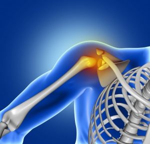 pain-shoulder-joint-chrysa-vafeiadi-physio